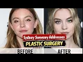 The Truth About Sydney Sweeney and Plastic Surgery Truth Revealed