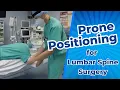 Prone Positioning for Lumbar Spine Surgery