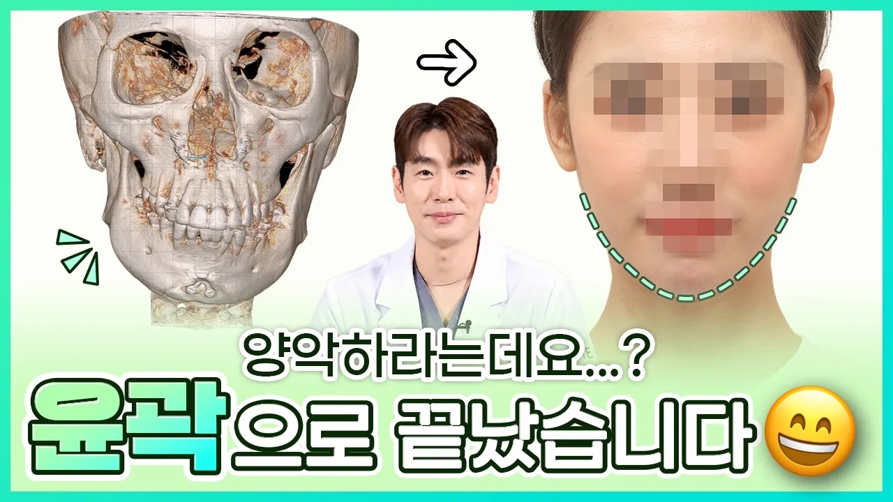 [노트윤곽센터] 양악수술 vs 안면윤곽 차이, 안면비대칭 실제 케이스 리뷰  l  이경민 원장