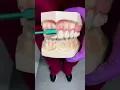 Download Lagu Dental Do's \u0026 Don'ts
