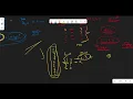 Top K Frequent Elements LeetCode 347 Java