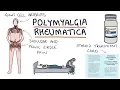 Download Lagu Polymyalgia Rheumatica: Visual Explanation for Students