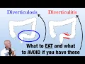 Diverticulitis What to eat
