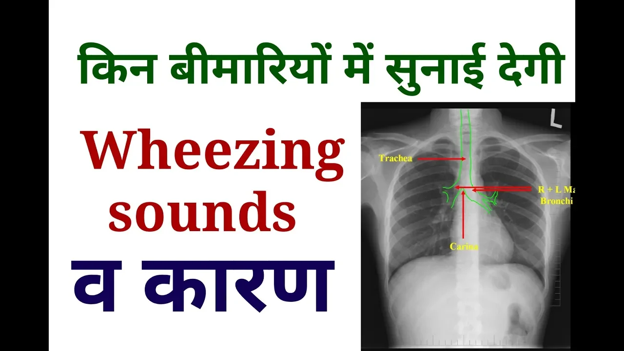 Wheezing Sounds  |   Causes OF wheezing Sounds  |  Lungs Examination