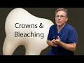 Download Lagu Dr  Kopp Crowns \u0026 Bleaching