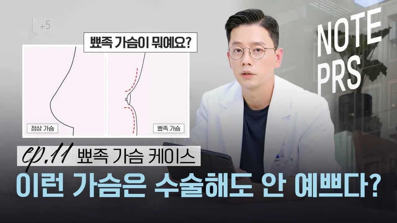 [가슴리뷰] 수술해도 소용없는 가슴? l 이런 사람은 수술 못하나요? l 뾰족가슴