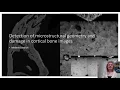 Detection of microstructural geometry and damage in cortical bone images
