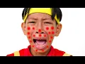 Download Lagu I'm So Itchy Song 5 | Nursery Rhymes \u0026 Children's Song