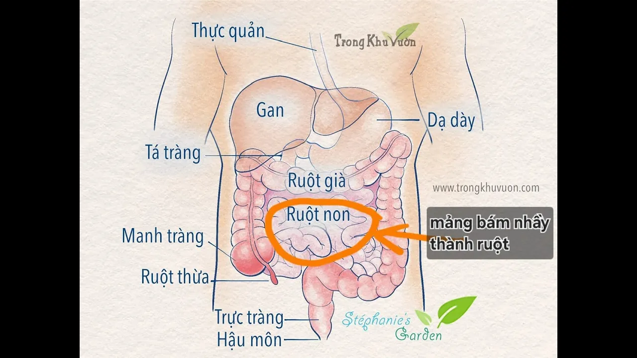 Outline Video Tiêu hóa & Đường ruột (Phần 4): Tác hại của thực phẩm lợi khuẩn (lên men) và Mảng bám thành ruột