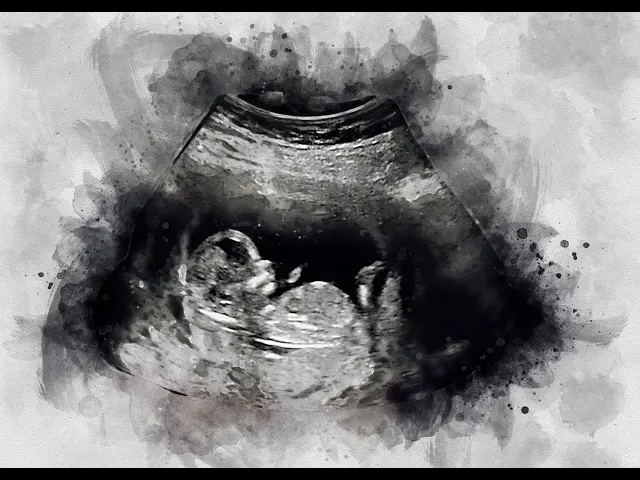 background images