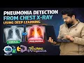 Pneumonia Detection from Chest X-ray using Deep Learning Tuberculosis TB Detection