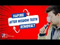 Can I Vape After Wisdom Teeth Removal