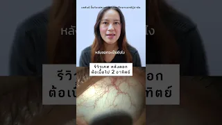  ต้อเนื้อคืออะไร และเกิดจากสาเหตุใด 