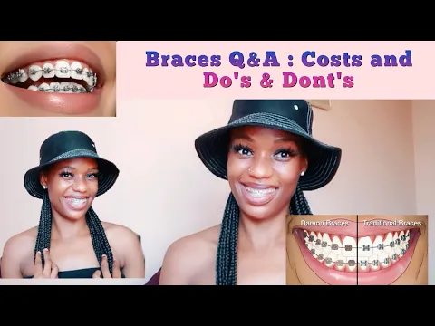 Download MP3 Braces Cost in South Africa // Prices from Different Orthodontists.