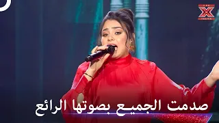 شيماء عمران ابهرت الملايين باداءها العظيم   اكس فاكتور الموسم   دندنها