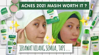 Download REVIEW PAKE ONE BRAND SKINCARE ACNES SELAMA 3 MINGGU HASILNYA ... MP3