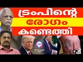 Download Lagu ട്രാംപിന്റെ സിരകളിൽ രോഗം | ABC TALKS | TRUMP