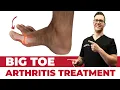 Stiff Big Toe Joint Pain Hallux Rigidus TREATMENT Exercises Taping