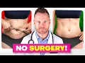 Top 10 Ways To Tighten Loose Skin WITHOUT Surgery