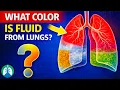 What Color is Fluid Drained From the Lungs Warning Signs
