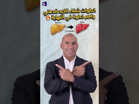 خطوات شفاء الكبد الدهني ب 3 اشهر واهم خطوة في النهاية 🔥