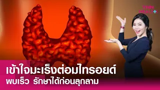 ก้อนที่คอที่มีความเสี่ยงเป็นมะเร็งต่อมไทรอยด์มีลักษณะอย่างไรบ้าง