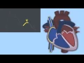 Interpreting Central Venous Pressure Waveforms by J DiNardo OPENPediatrics