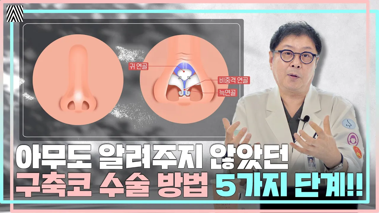 '구축코 교정 수술'에는 반드시 OO조직이 필수입니다!! 구축코 2편_[4월31일 성형외과]