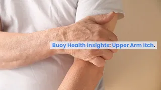 Upper Arm Itch Common Causes and When to Seek Medical Care BuoyHealth com