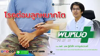  การรักษาต่อมลูกหมากโตมีวิธีใดบ้างสำหรับผู้ที่มีอาการน้อย 