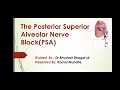 Posterior Superior Alveolar Nerve Block