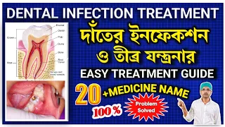 Download Dental infection treatment in bangla|Tooth infection treatment|Tooth infection medicine|#dental MP3