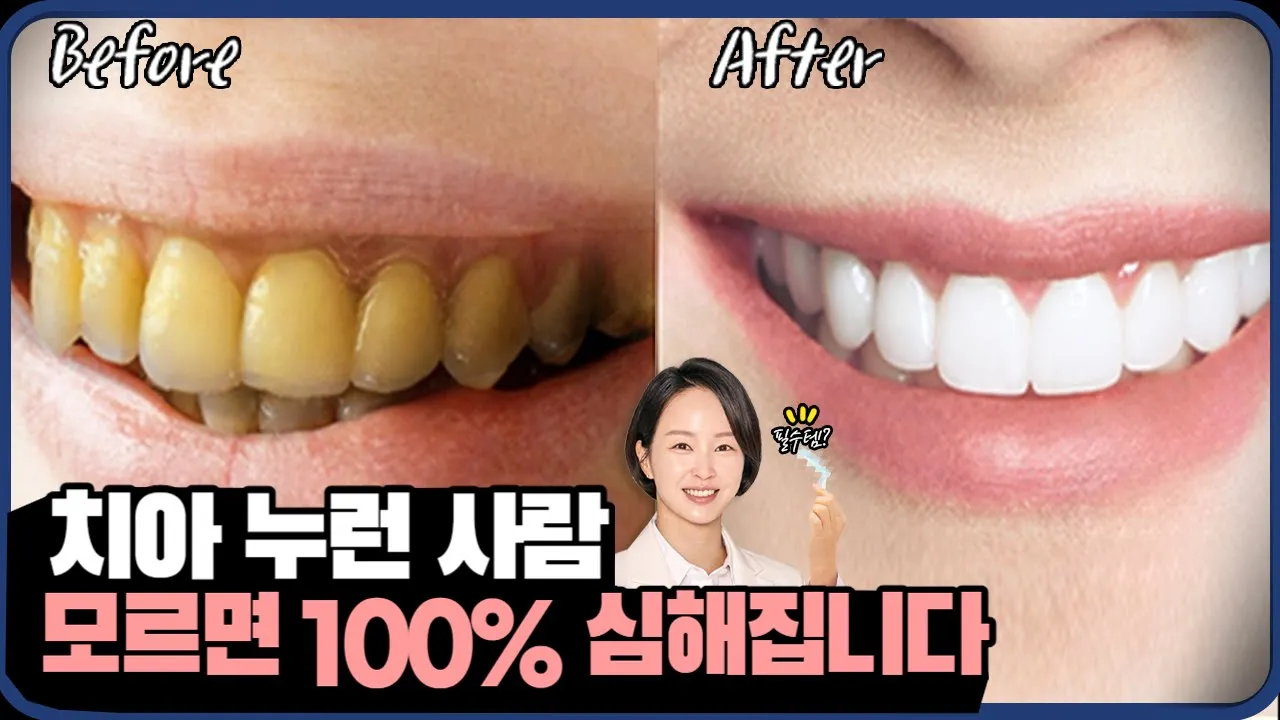 ()치과 안 가고 누런 이 막는 방법 ㅣ강남 치과 원장이 알려드립니다.
