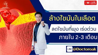 ทำไมการนอนหลับให้เพียงพอจึงสำคัญต่อการลดไขมันในเลือดและผอมลง
