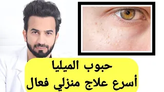 حبوب الميليا الحبوب البيضاء في الوجه تحت العين اسرع علاج منزلي فعال دكتور طلال المحيسن 