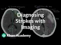 Diagnosing strokes with imaging CT MRI and Angiography NCLEX-RN Khan Academy