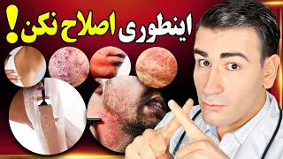 چگونه اصلاح شیو کنیم که پوستمون تیره نشه و درگیر موی زیرپوستی جوش و خارش نشویم How To Shave  چگونه اصلاح شیو کنیم که پوستمون تیره نشه و درگیر موی زیرپوستی جوش و خارش نشویم How To Shave