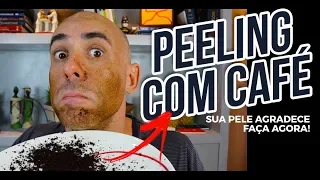 PEELING CASEIRO PARA TIRAR MANCHAS DO ROSTO | Dr Dayan Siebra
