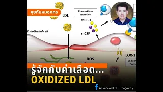 ทำไมการตรวจออกซิ LDL ถึงมีราคาแพงและหาที่ตรวจได้ยากในประเทศไทย