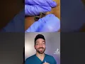 Giant cyst dermdoctor