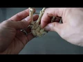 SKELETAL SYSTEM ANATOMY Bones of the wrist hand and fingers