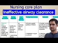 Nursing care plan on Ineffective airway clearance Ineffective airway clearance Nursing care plan