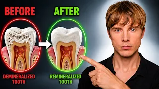 The Viral Toothpaste That Remineralizes Your Teeth