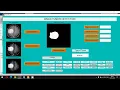 Brain tumor detection using SVM classifier MATLAB