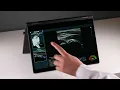 Revolutionizing Elbow Diagnostics in Primary Care with SmartAlpha s AI Ultrasound