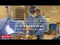 Download Lagu L3-5 MIS TLIF for Scoliosis