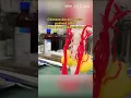 Download Lagu Chinese doctors save patient after 'head-neck dissociation'