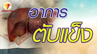 ตับแข็งมีอาการอย่างไร