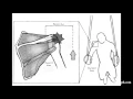 Shoulder Rehab Case Study
