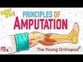 Download Lagu Amputation Principles | ANIMATION | BASICS | NEET PG | Amputee - The Young Orthopod